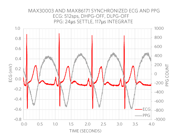 ECG and PPG correlated data plot.