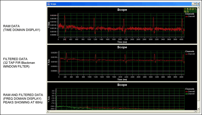 Figure 5. Collected EKG data.