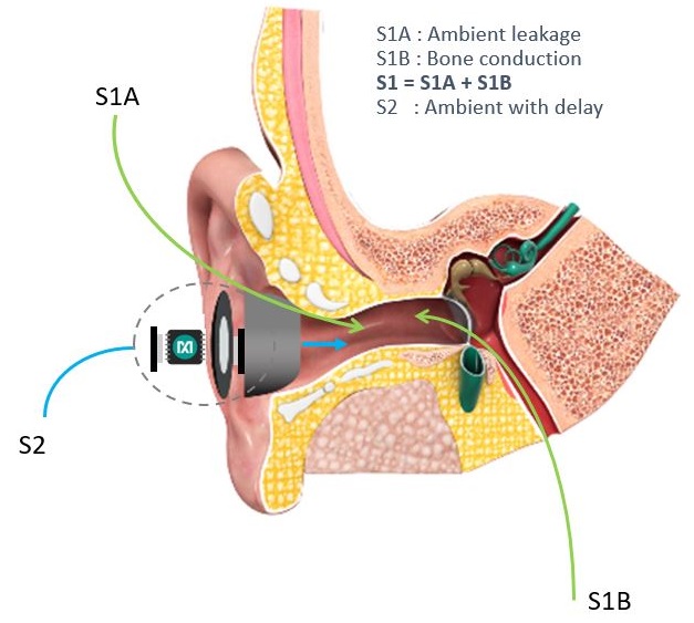 Figure 2. Two sounds reaching the eardrum in PSAP.