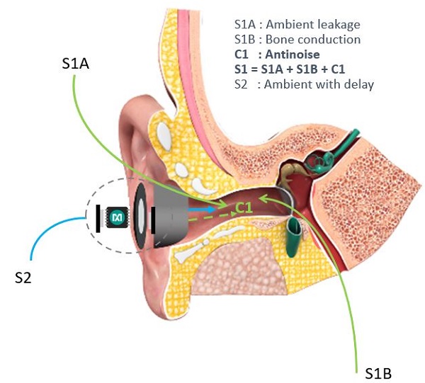 Figure 7. Two sounds reaching the eardrum in PSAP with anti-noise.