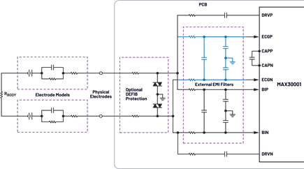 Figure 1. Two electrode ECG and respiration monitoring.