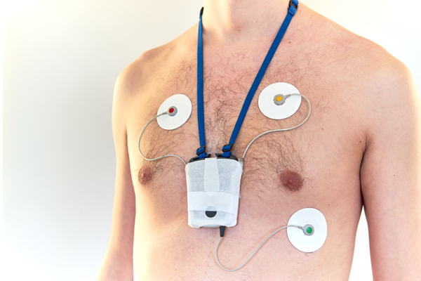 Figure 1. Holter heart monitor.