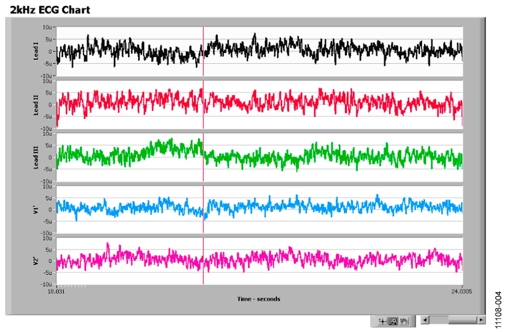 Screen Capture of ADAS1000 Noise Measurements in Lead Mode