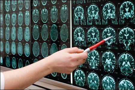 MRI Scans.