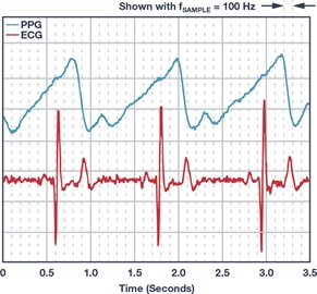 ECG measurement combined with PPG.
