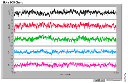 Screen Capture of ADAS1000 Noise Measurements in Lead Mode