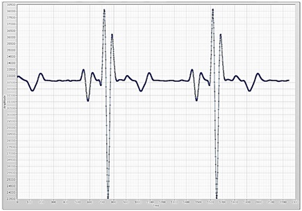 Two electrodes measurement