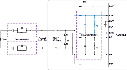 Figure 1. Two electrode ECG and respiration monitoring.