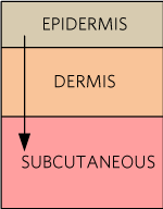 The three layers of skin.