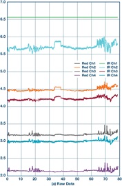 Raw data of four-channel measurement for standing still and chewing