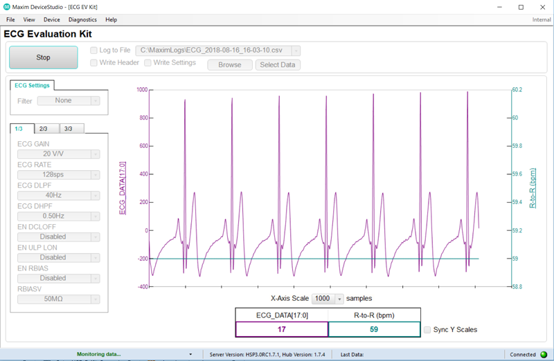 Figure 4. Evaluation software analyzes ECG measurements.